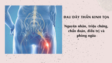 Đau dây thần kinh tọa - Sciatica