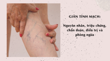 Giãn tĩnh mạch - Varicose Vein